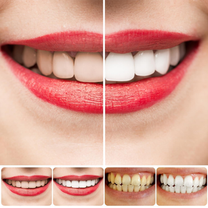 SP-8/SP-10 Pasta dental probiótica blanqueadora para la salud bucal